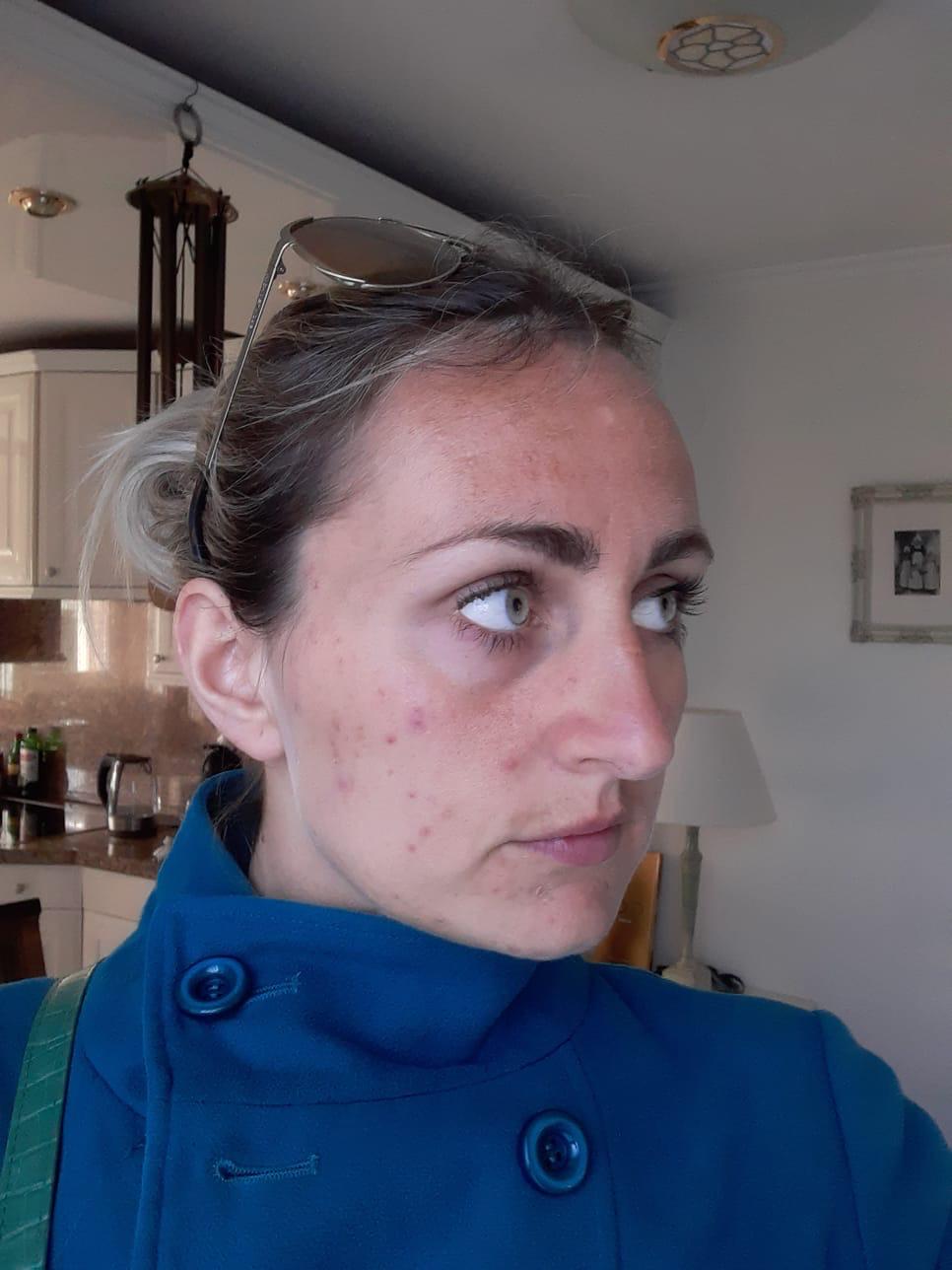 Stralende huid en skincare